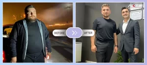Gastric Bypass Surgery Before - After