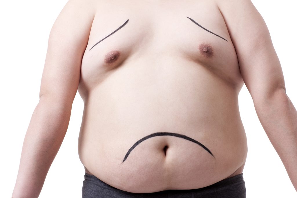 Gynecomastia Surgery
