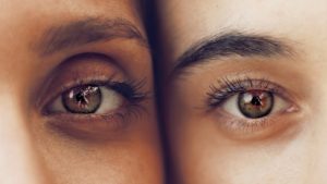 Estética del ojo de almendra