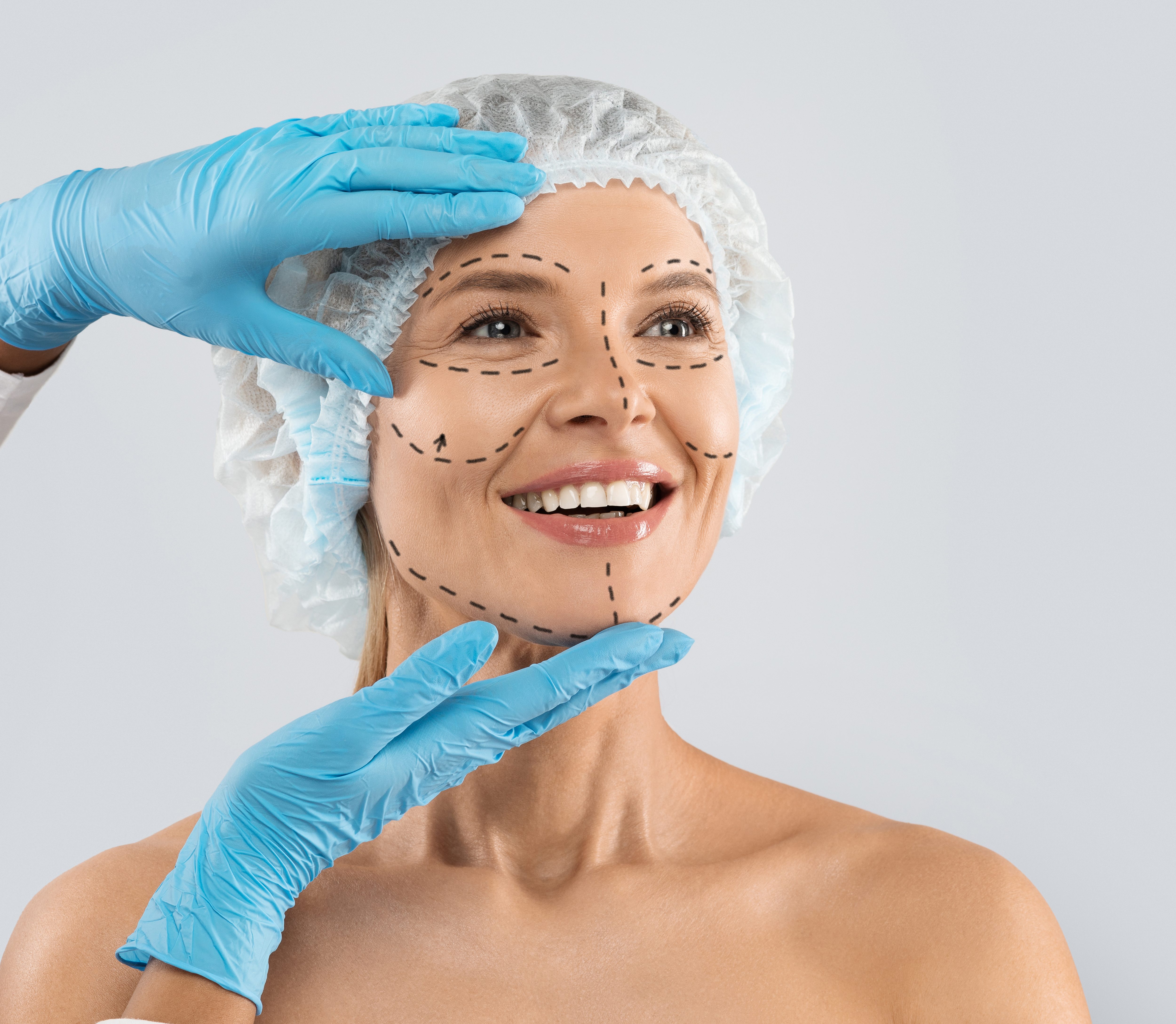 Operația de lifting facial 